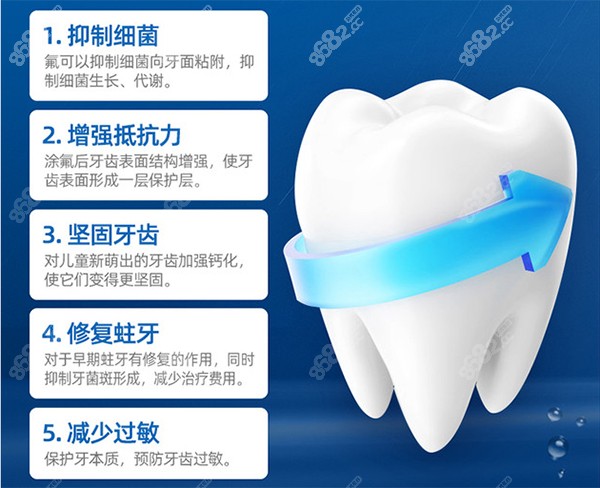 儿童全口涂氟的五大作用