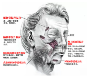 成都面部提升哪家医院好