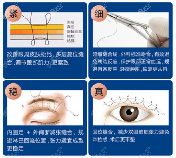 DL精细固位缝合创口特点