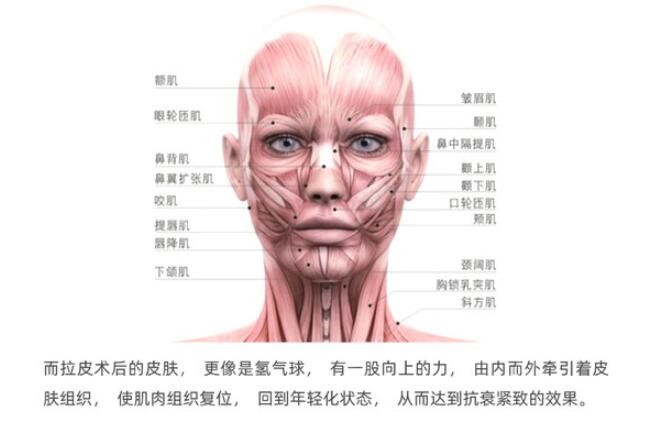 拉皮提升手术图解