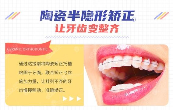 陶瓷半隐形矫正牙套的收费标准