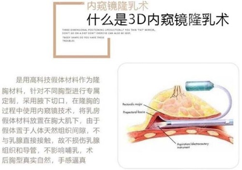 乌鲁木齐华美整形隆胸优势介绍