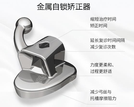 珠海金属自锁矫正器的费用