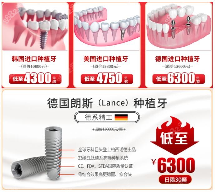 广州广大口腔进口种植牙价格表