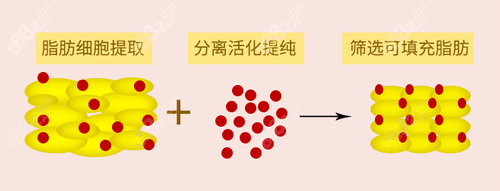 李奇军做自体脂肪面部填充怎么样？脂肪成活率高