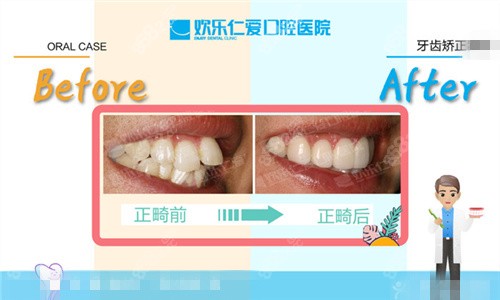 沈阳欢乐仁爱口腔正畸