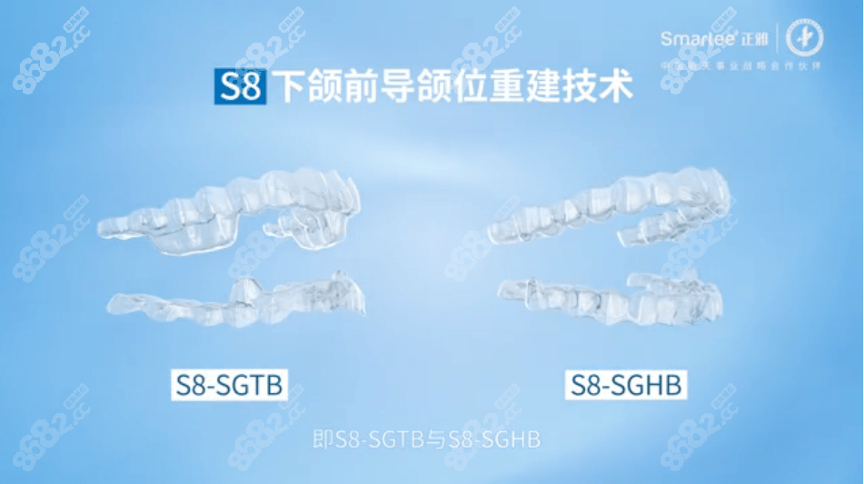 S8颌位重建隐形矫正技术