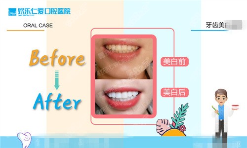 沈阳欢乐仁爱口腔牙齿美白
