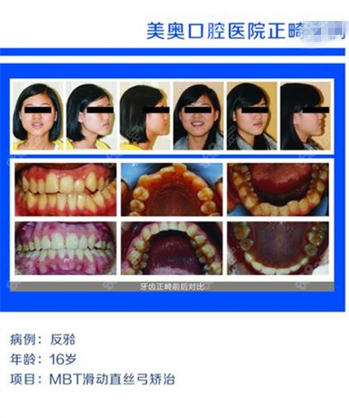 南京美奥口腔反颌正畸对比