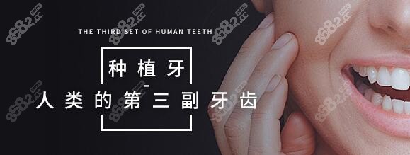 种植牙人类的第三幅牙齿