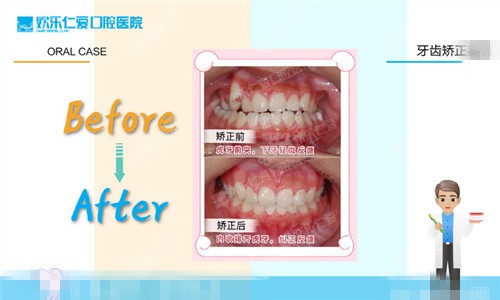 沈阳欢乐仁爱口腔牙齿矫正