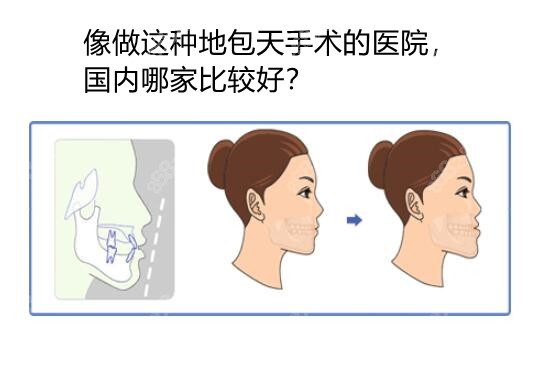 国内地包天手术医院