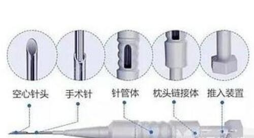 上海碧莲盛脂肪技术优势介绍