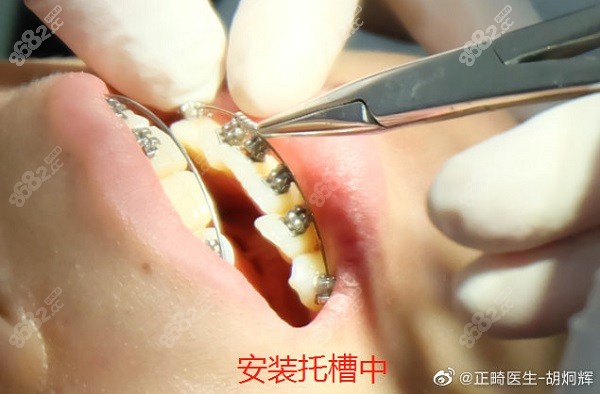 重庆牙博士口腔医院牙齿矫正