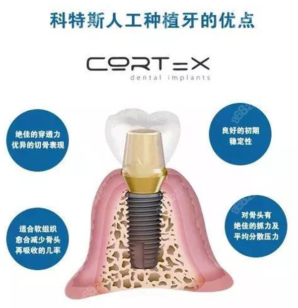 以色列科特斯Cortex