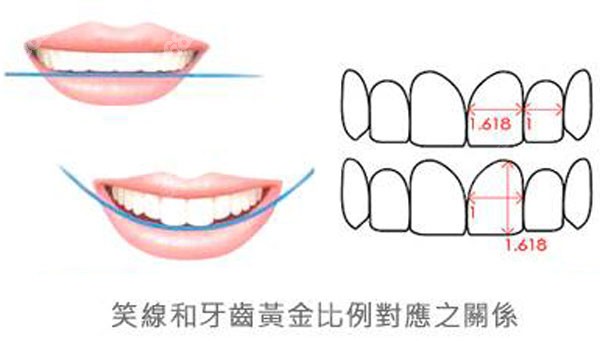笑线和牙齿黄金比例
