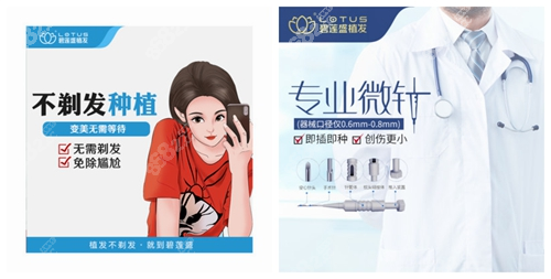 <!--<i data=20240705-sp></i>-->不剃发微针植发