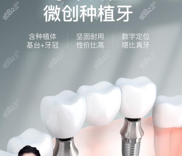 上海松丰齿科种植牙技术优势