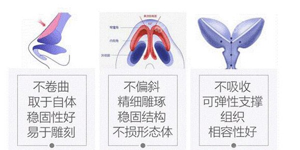 西区做鼻修复有三不原则