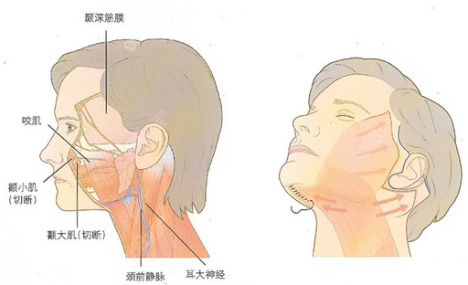 徐红霞密速提面部手术价格是多少呢？