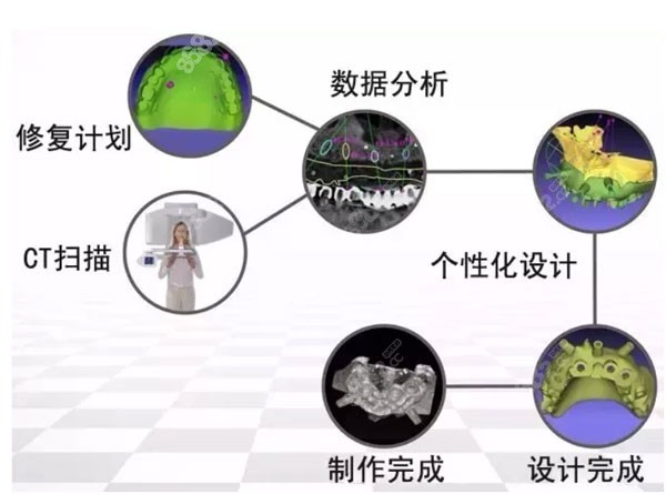 3D数字化种植牙