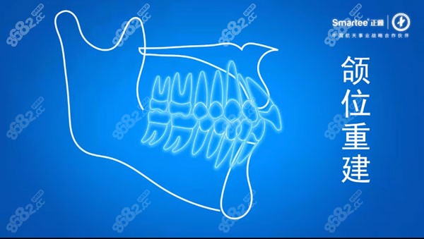 正雅S8颌位重建