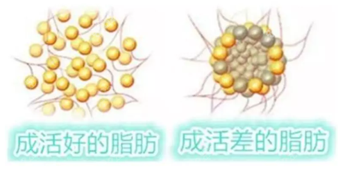 抽取的脂肪完成、成活好