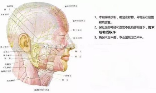 取不明注射物的方法