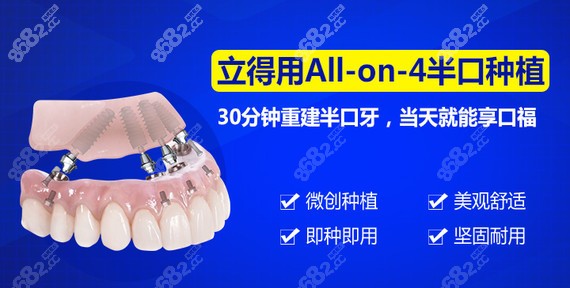 西安中诺口腔立得用全口种植牙技术