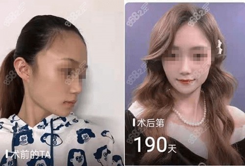 对比照