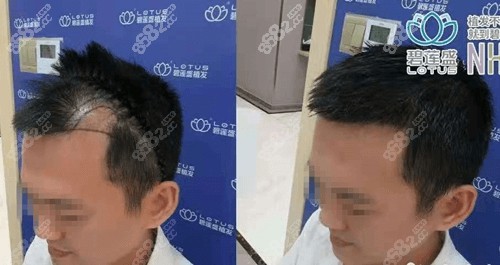 对比照