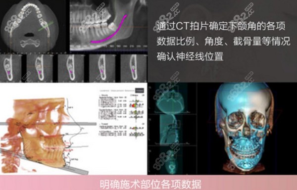 上海美联臣颅颌面CT