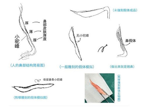 <!--<i data=20240705-sp></i>-->做鼻子技术