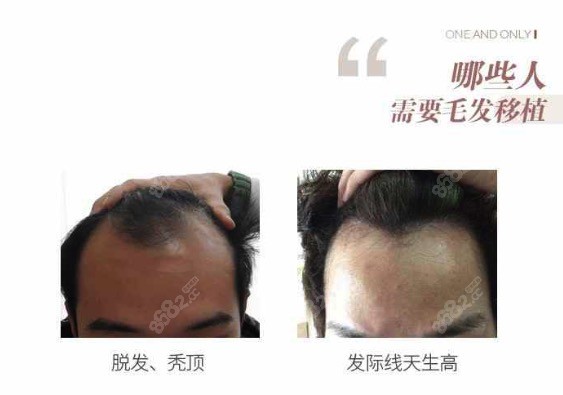 武汉壹加壹整形医院植发科