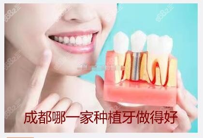 成都哪一家种植牙做得好