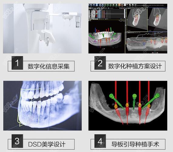 天津中诺口腔医院种植牙优势