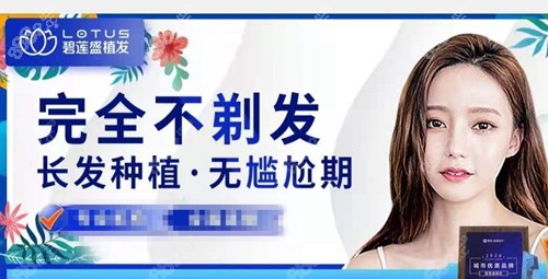 <!--<i data=20240705-sp></i>-->完全不剃发植发优势