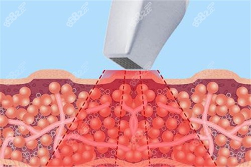 熱瑪吉原理 熱瑪吉原理