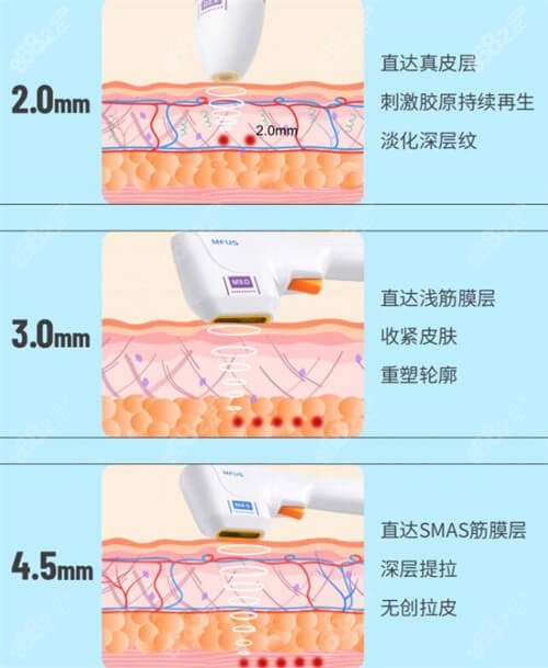 半岛超声炮的治疗原理