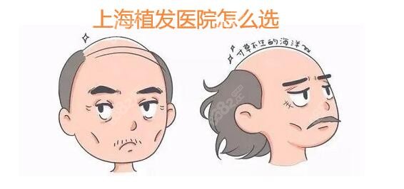 上海植发医院哪家医技术好