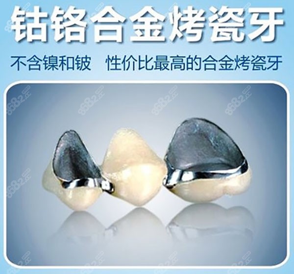 美冠塔口腔钴铬合金烤瓷牙