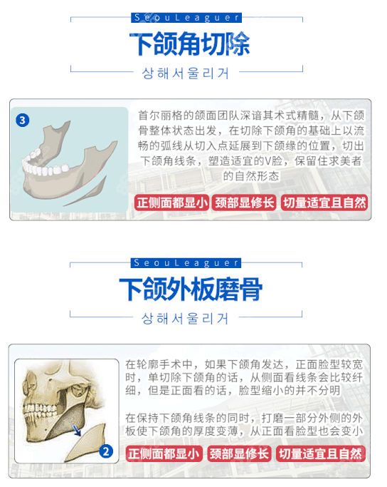 下颌角切除的方法