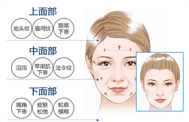 深圳军科小切口拉皮适应症