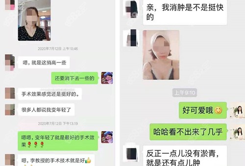 集美们对李晓东面部提升的评价