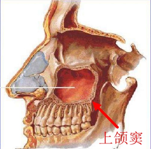 上颌窦的准确位置图片图片