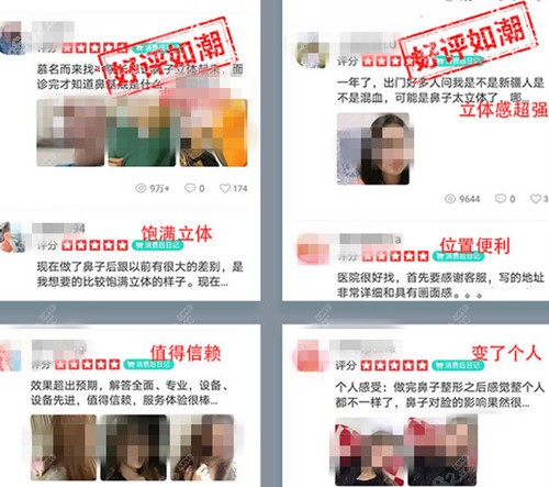 邓正辉医生的隆鼻实例评价