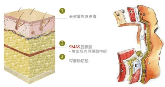 深圳艺星文峰做小切口面部拉皮作用层次示意图