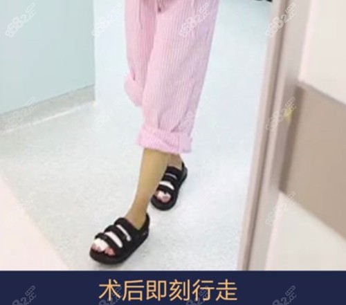 邱立东做大脚骨术后即刻