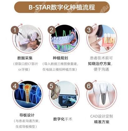 B-STAR数字化种植优势：当天看牙，当天用