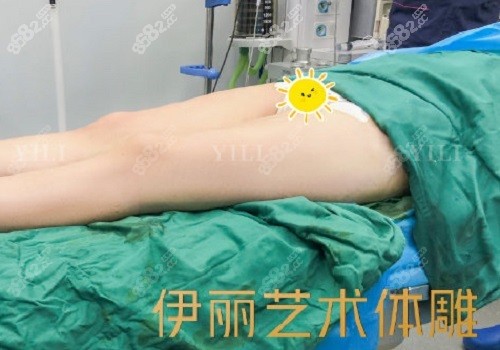 <!--<i data=20240705-sp></i>-->医疗美容医院大腿吸脂